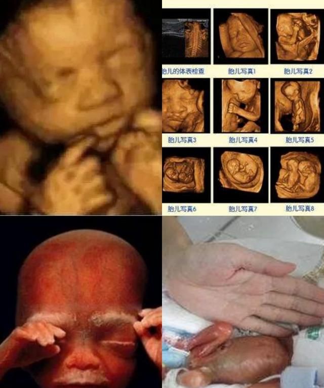 怀孕三个月胎儿图，怀孕7个月胎儿头在哪里图片图1