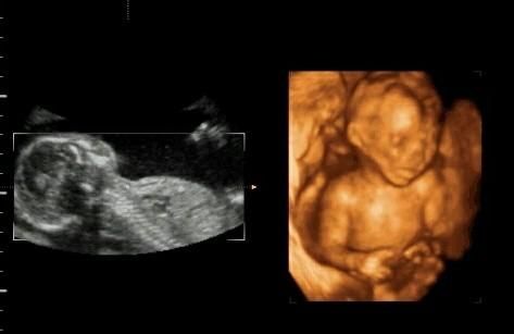怀孕三个月胎儿图，怀孕7个月胎儿头在哪里图片图5