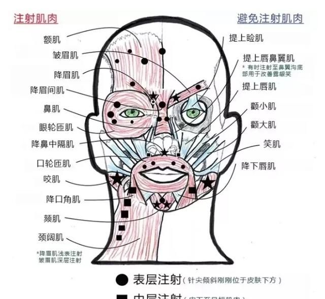 注射瘦脸针有危险吗图10