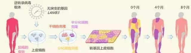 植皮手术后皮肤图：哈桑的皮肤移植图5