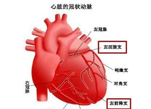 哪些人容易心源性猝死，哪些人容易发生心源性猝死图7