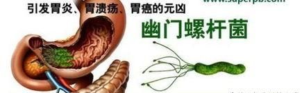 幽门螺旋杆菌治疗时间，幽门螺杆菌感染治疗后多久再复查图2