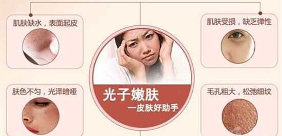 光子嫩肤面部皱纹，光子嫩肤能改善皮肤暗黄吗图2