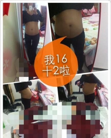 16周胎儿生殖部分男女看不清图4