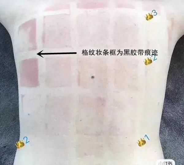 如何快速美白全身，如何在两个月内全身快速美白图2