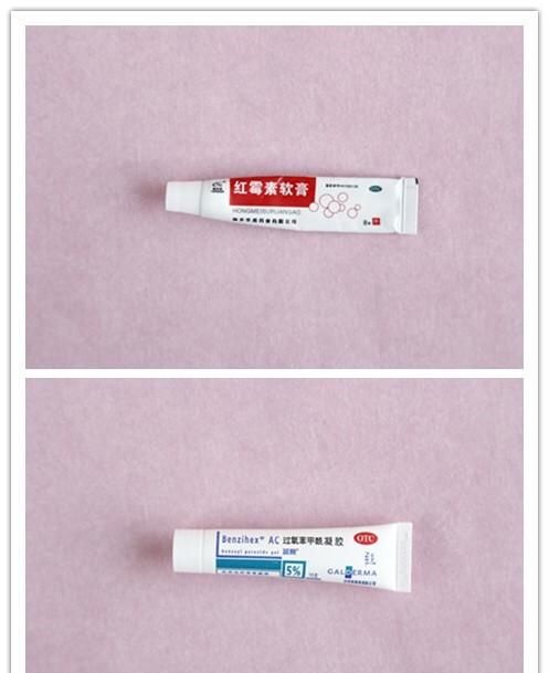 如何治痘痘最有效的方法图7