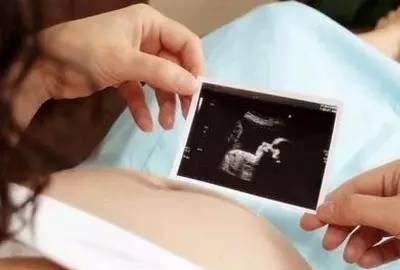 怀孕三个月半胎儿图，为什么怀孕三个月后还会胎停图1
