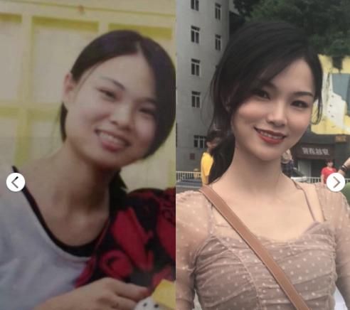 注射瘦脸美容，注射瘦脸针有危险吗图12