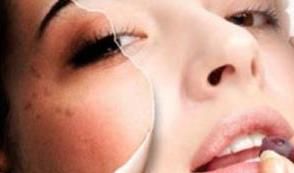 如何去掉色斑，如何去除脸上的斑点图11