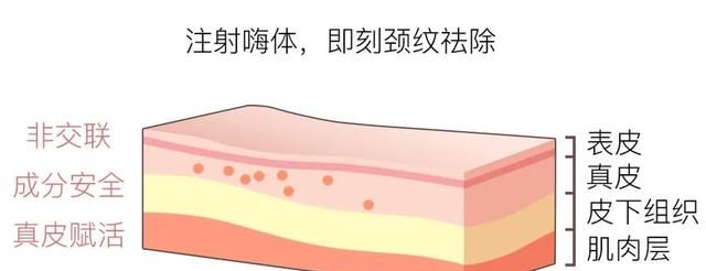 颈部去皱，怎么保养颈部皱纹图7