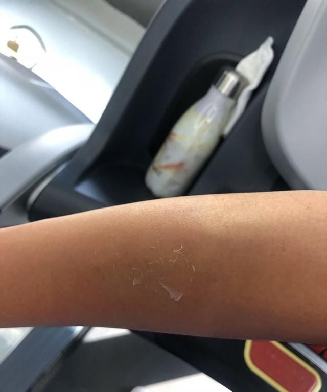 晒后修复美白用什么图4