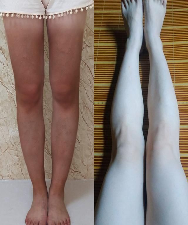 晒后修复美白用什么图8