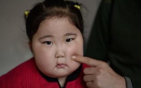 早上起来脸肿，早上起来为什么脸是肿的