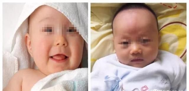 面部填充物，面部填充能保持多久图7