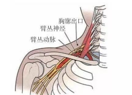 手臂疼痛怎么回事，手臂无缘无故的疼痛是怎么回事图3