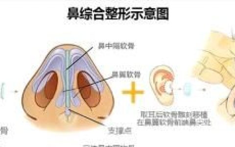鼻综合是什么整容项目