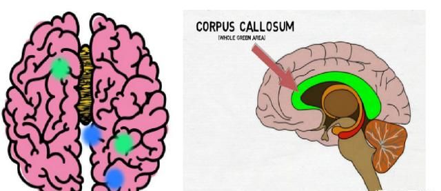 右脑发达，右脑比左脑发达怎么办图2