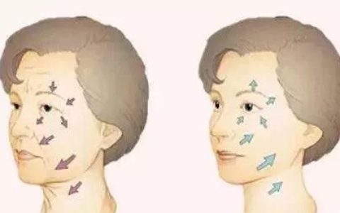 光子嫩肤有什么作用，做光子嫩肤有什么效果