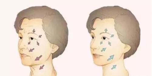 光子嫩肤有什么作用，做光子嫩肤有什么效果图1