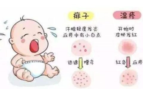 湿疹是什么症状，湿疹有什么症状