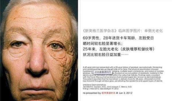 怎样变白从小就超级黑，真的哭死了，特别黑，全身黑，怎么美白图11
