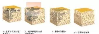 怎么样能有效祛斑图6
