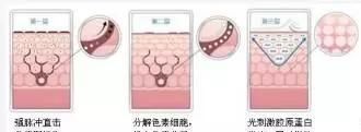 怎么样能有效祛斑图7