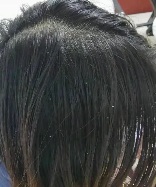 怎么改善油性头发图1