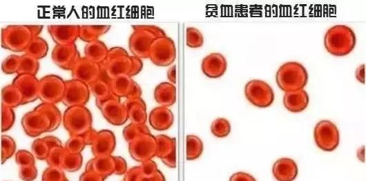 红细胞多，红细胞增多怎么回事儿图9