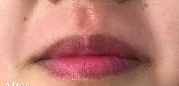 e光脱毛多少钱，脱毛蜜蜡多少钱图10