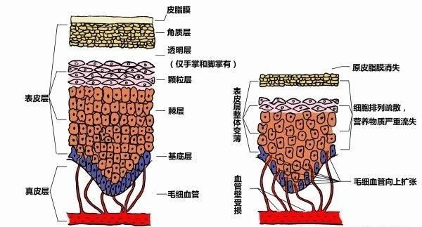 红血丝怎么去除最有效图1