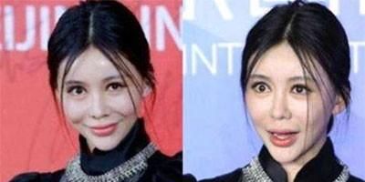 脸瘦咬肌大适合打瘦脸针吗图5