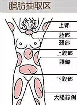 自体脂肪填充下眼睑，自体脂肪填充丰胸安全吗图4