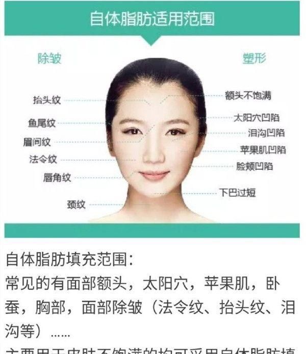 自体脂肪填充下眼睑，自体脂肪填充丰胸安全吗图8