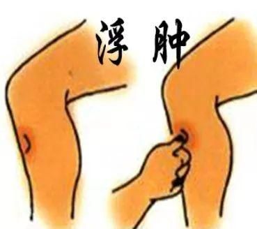 肝功能异常身体会出现什么表现图4