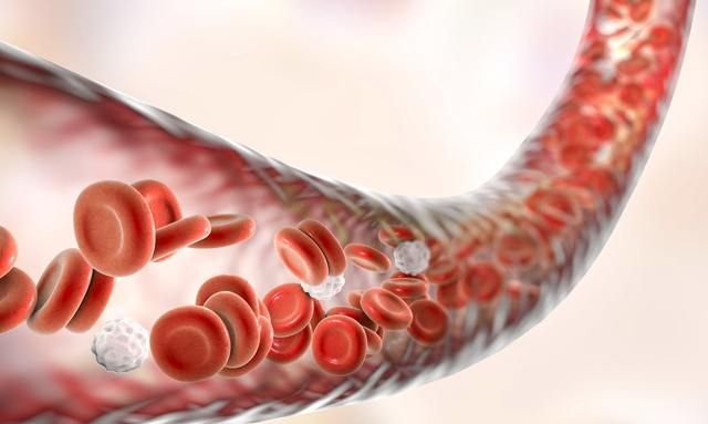软化血管的食物，什么食物能软化血管清洁血管图1