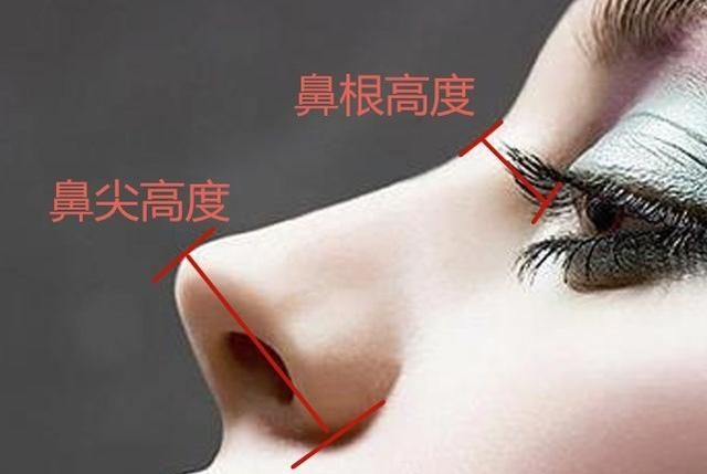 鼻子垫高整形多少钱图3