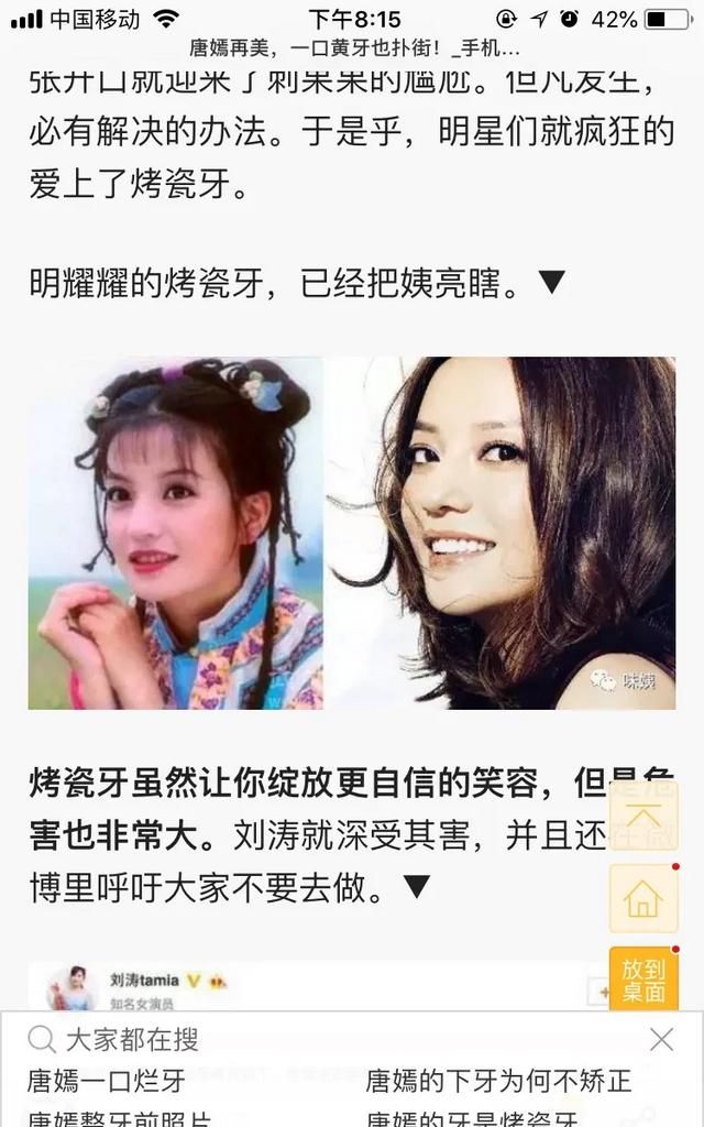 牙齿美容冠，牙齿可以美容吗图3