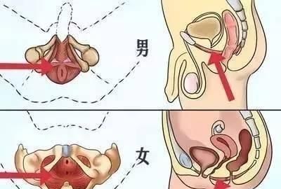 提肛运动怎么做，怎样提肛运动是正确的图3