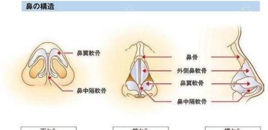 如何缩小鼻翼不手术图3