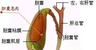 胆囊息肉怎么才能治得好，胆囊息肉怎么治疗最好的方法图2