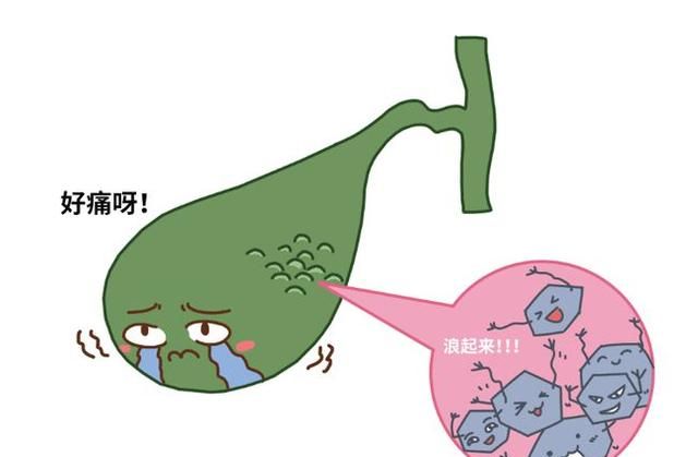 胆囊息肉怎么才能治得好，胆囊息肉怎么治疗最好的方法图4