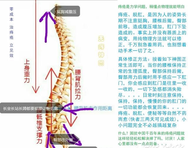 痔疮手术的费用，切痔疮手术多少钱图1