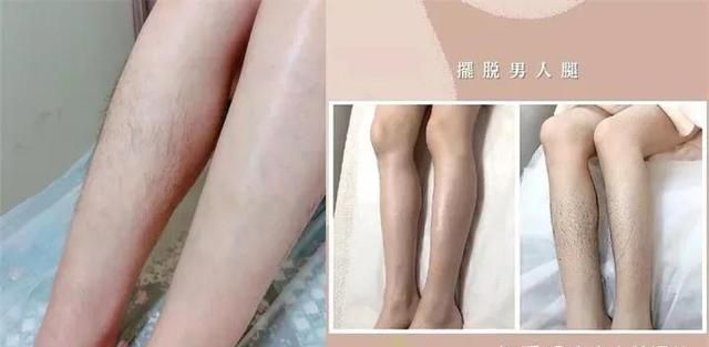 怎样去除腋毛，怎么去腋毛去的干净图5