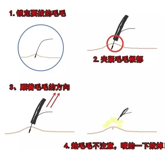 怎样去除腋毛，怎么去腋毛去的干净图10