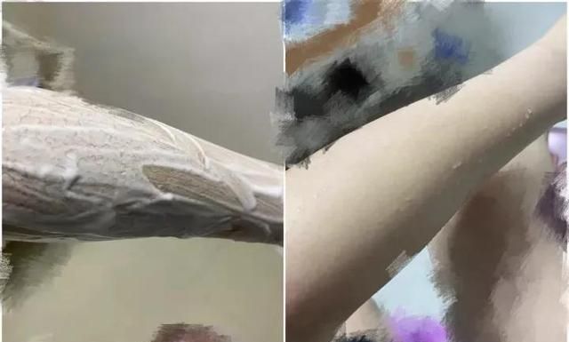 怎样去除腋毛，怎么去腋毛去的干净图11