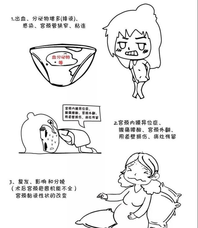 宫颈leep手术影响生育吗图2