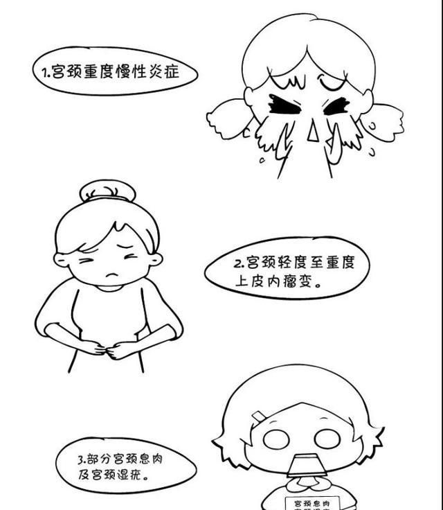 宫颈leep手术影响生育吗图3