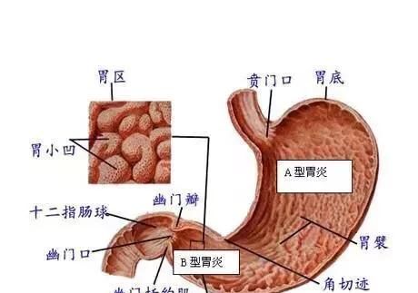 胃窦炎吃什么药，慢性胃窦炎怎么调养能好图1