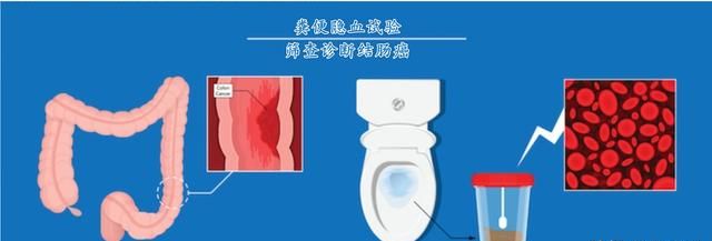 大便带血，大便拉出大量血怎么办图13